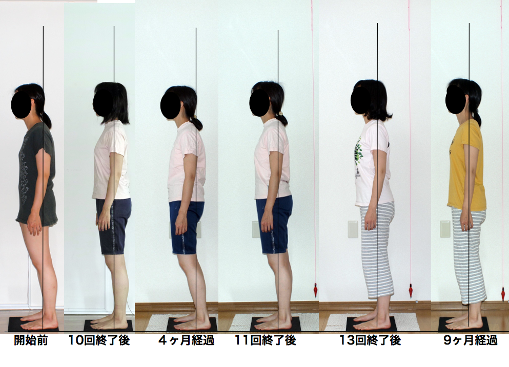 継続するロルフィング効果