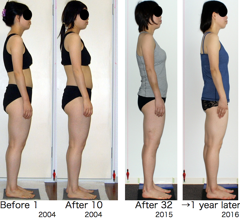 ロルフィング継続効果3