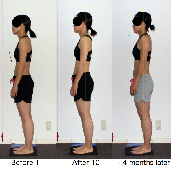 ロルフィング継続効果2